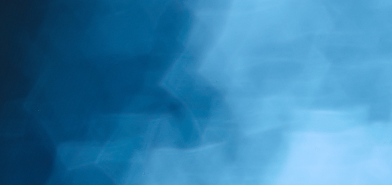 Triton Position on Recent Media Reports